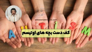 کف دست بچه های اوتیسم